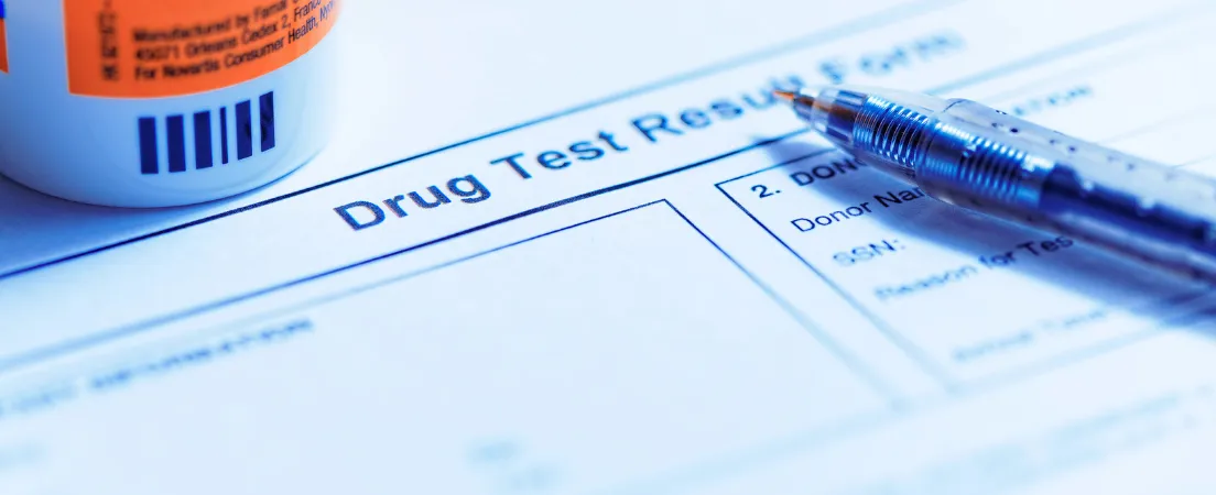 what's next after a failed military drug test concept pic shows testing form and pen
